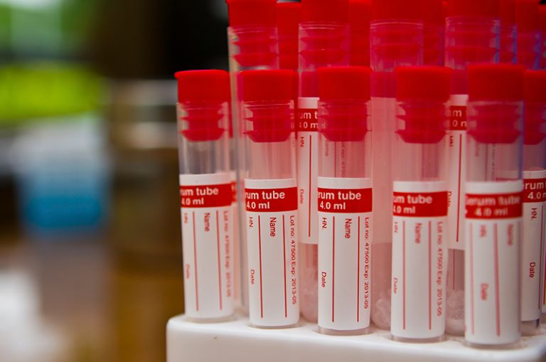 Red Trouser Day is helping fund a new Blood test to detect Bowel Cancer