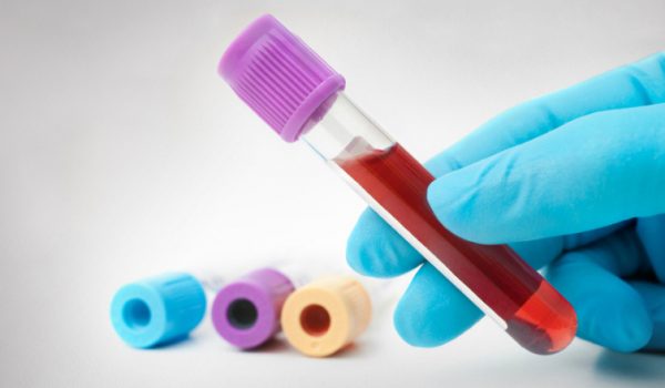 Blood-test-1